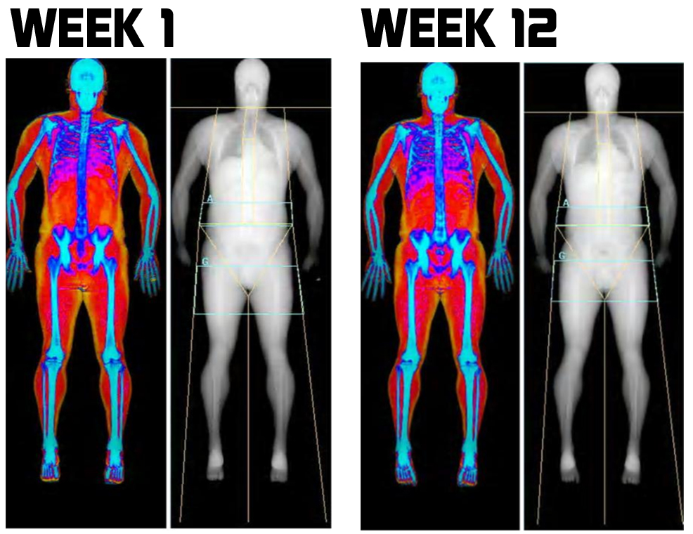 Before and after Dexa Scan