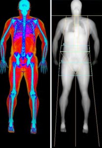 Dexa Scan at Week 5